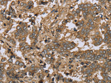 IKBIP Polyclonal Antibody Store at -20°C - MSE Supplies LLC