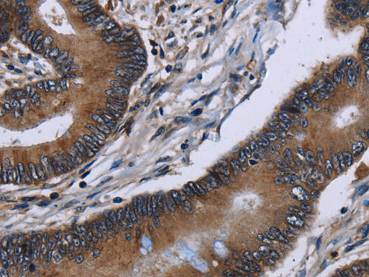 ITGAE Polyclonal Antibody Store at -20°C - MSE Supplies LLC