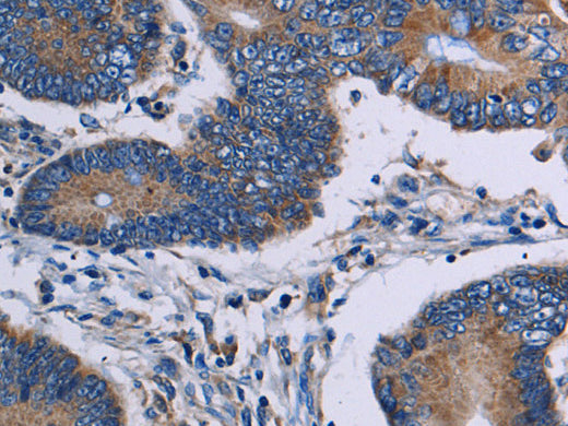 ITK Polyclonal Antibody Store at -20°C - MSE Supplies LLC