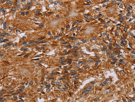 JAKMIP2 Polyclonal Antibody Store at -20°C - MSE Supplies LLC