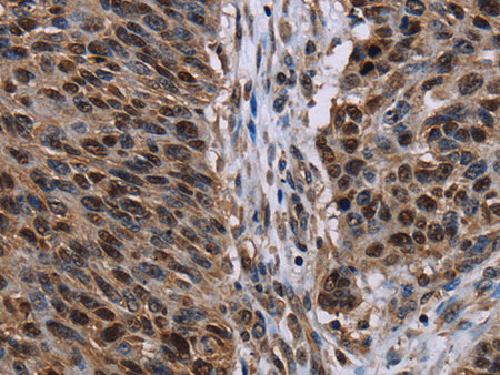 KDM3B Polyclonal Antibody Store at -20°C - MSE Supplies LLC