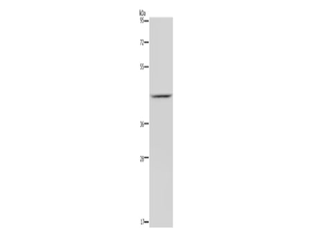 JMJD6 Polyclonal Antibody Store at -20°C - MSE Supplies LLC