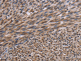 KIF2A Polyclonal Antibody Store at -20°C - MSE Supplies LLC