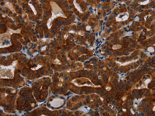 KLHL1 Polyclonal Antibody Store at -20°C - MSE Supplies LLC