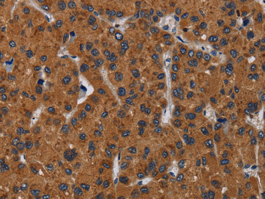 KLK8 Polyclonal Antibody Store at -20°C - MSE Supplies LLC