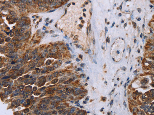 DDX11 Polyclonal Antibody Store at -20°C - MSE Supplies LLC
