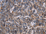 LDOC1 Polyclonal Antibody Store at -20°C - MSE Supplies LLC