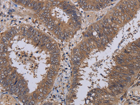 P3H3 Polyclonal Antibody Store at -20°C - MSE Supplies LLC