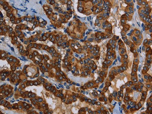 PIDD1 Polyclonal Antibody Store at -20°C - MSE Supplies LLC