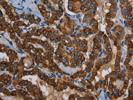 PIDD1 Polyclonal Antibody Store at -20°C - MSE Supplies LLC