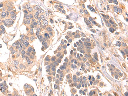 LRRC15 Polyclonal Antibody Store at -20°C - MSE Supplies LLC