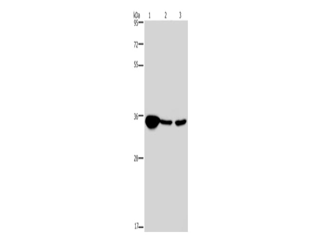 LZTFL1 Polyclonal Antibody Store at -20°C - MSE Supplies LLC