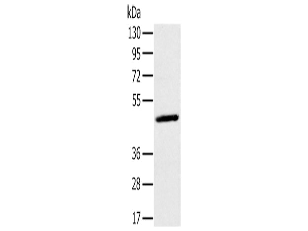 MAGEA10 Polyclonal Antibody Store at -20°C - MSE Supplies LLC