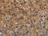 TAB1 Polyclonal Antibody Store at -20°C, Biomarkers, Elabscience Biotechnology, MSE Supplies