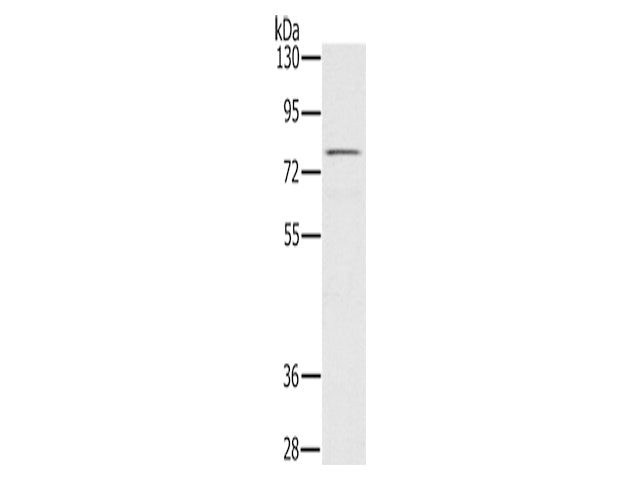 TAB3 Polyclonal Antibody Store at -20°C, Biomarkers, Elabscience Biotechnology, MSE Supplies