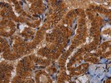WDR83 Polyclonal Antibody Store at -20°C, Biomarkers, Elabscience Biotechnology, MSE Supplies