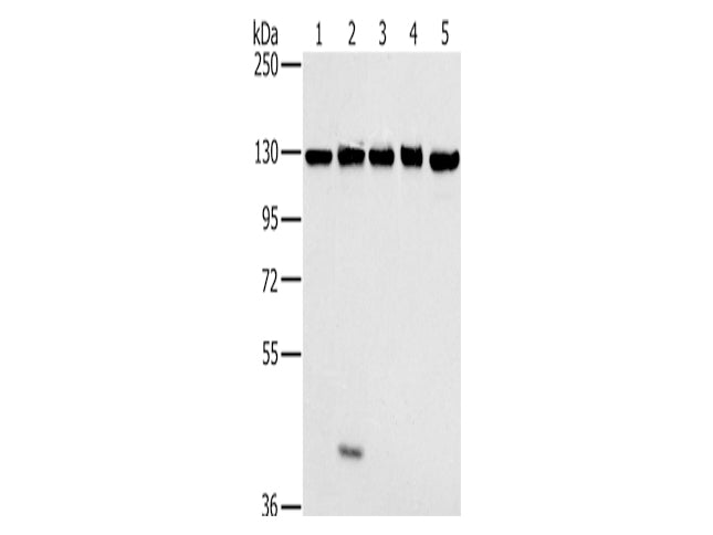 MATR3 Polyclonal Antibody Store at -20°C, Biomarkers, Elabscience Biotechnology, MSE Supplies