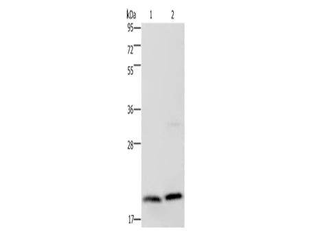 MCTS1 Polyclonal Antibody Store at -20°C, Biomarkers, Elabscience Biotechnology, MSE Supplies