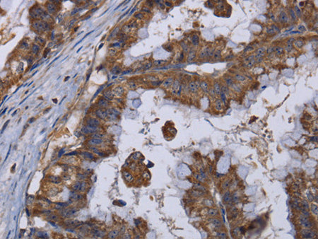 MT3 Polyclonal Antibody Store at -20°C, Biomarkers, Elabscience Biotechnology, MSE Supplies