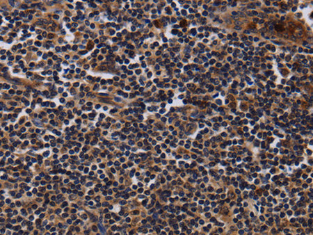 NTMT1 Polyclonal Antibody Store at -20°C, Biomarkers, Elabscience Biotechnology, MSE Supplies