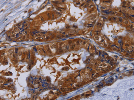 MFAP3L Polyclonal Antibody Store at -20°C, Biomarkers, Elabscience Biotechnology, MSE Supplies