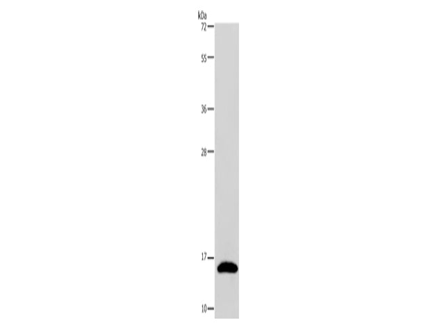 REG3G Polyclonal Antibody Store at -20°C, Biomarkers, Elabscience Biotechnology, MSE Supplies