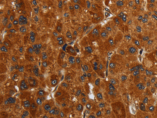 ENTPD7 Polyclonal Antibody Store at -20°C, Biomarkers, Elabscience Biotechnology, MSE Supplies