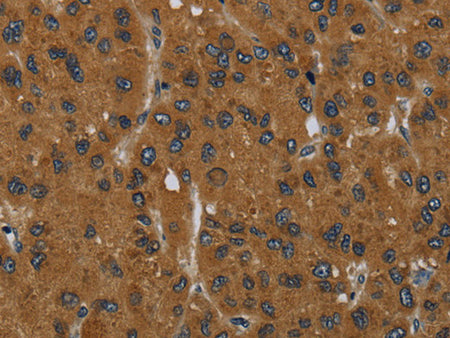 MIER2 Polyclonal Antibody Store at -20°C, Biomarkers, Elabscience Biotechnology, MSE Supplies