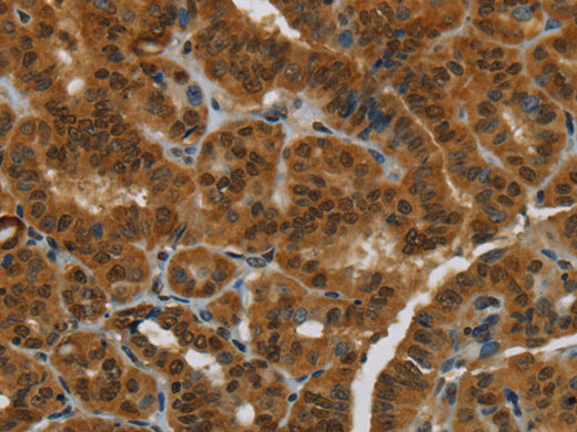 MRE11 Polyclonal Antibody Store at -20°C, Biomarkers, Elabscience Biotechnology, MSE Supplies