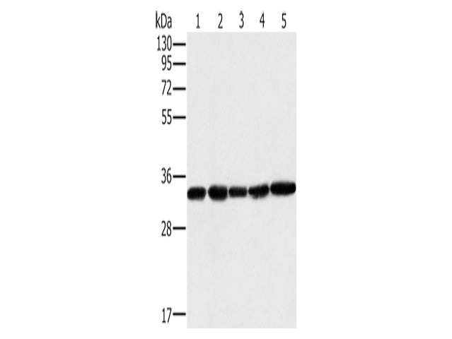 MTCH2 Polyclonal Antibody Store at -20°C, Biomarkers, Elabscience Biotechnology, MSE Supplies