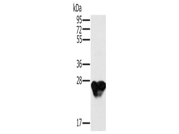 MYL3 Polyclonal Antibody Store at -20°C, Biomarkers, Elabscience Biotechnology, MSE Supplies