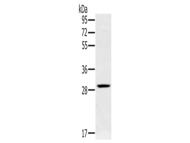 CLIC1 Polyclonal Antibody Store at -20°C, Biomarkers, Elabscience Biotechnology, MSE Supplies