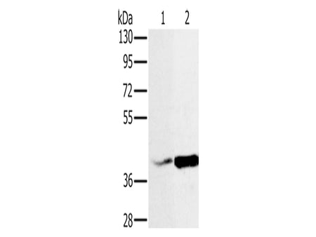 NDUFA10 Polyclonal Antibody Store at -20°C, Biomarkers, Elabscience Biotechnology, MSE Supplies