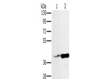 NDUFA10 Polyclonal Antibody Store at -20°C, Biomarkers, Elabscience Biotechnology, MSE Supplies