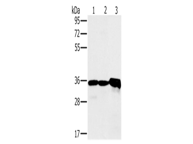 NDUFA9 Polyclonal Antibody Store at -20°C, Biomarkers, Elabscience Biotechnology, MSE Supplies