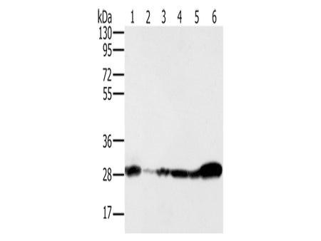 NDUFS3 Polyclonal Antibody Store at -20°C, Biomarkers, Elabscience Biotechnology, MSE Supplies