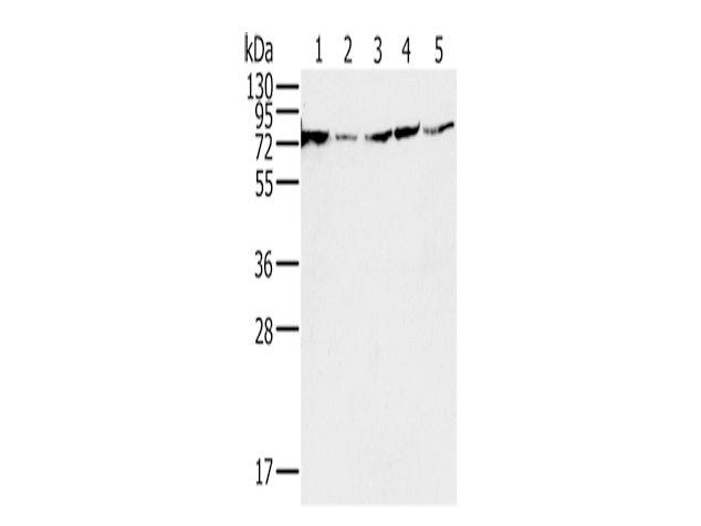 NDUFS1 Polyclonal Antibody Store at -20°C, Biomarkers, Elabscience Biotechnology, MSE Supplies