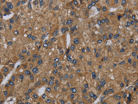 NDUFS6 Polyclonal Antibody Store at -20°C, Biomarkers, Elabscience Biotechnology, MSE Supplies