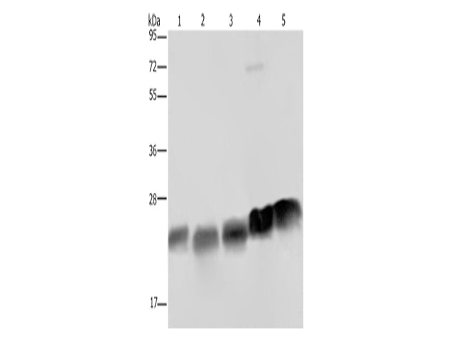 NDUFS8 Polyclonal Antibody Store at -20°C, Biomarkers, Elabscience Biotechnology, MSE Supplies