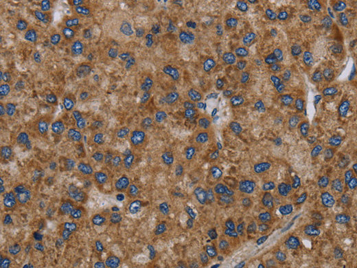 NECTIN2 Polyclonal Antibody Store at -20°C, Biomarkers, Elabscience Biotechnology, MSE Supplies
