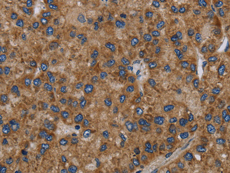 NECTIN2 Polyclonal Antibody Store at -20°C, Biomarkers, Elabscience Biotechnology, MSE Supplies