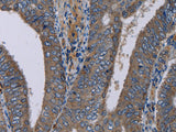 NECTIN4 Polyclonal Antibody Store at -20°C, Biomarkers, Elabscience Biotechnology, MSE Supplies