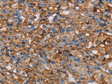 NEDD4L Polyclonal Antibody Store at -20°C, Biomarkers, Elabscience Biotechnology, MSE Supplies