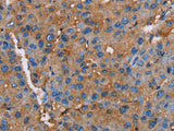 NLGN1 Polyclonal Antibody Store at -20°C, Biomarkers, Elabscience Biotechnology, MSE Supplies