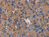 NCSTN Polyclonal Antibody Store at -20°C, Biomarkers, Elabscience Biotechnology, MSE Supplies