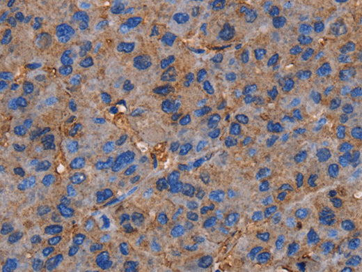 NRIP3 Polyclonal Antibody Store at -20°C, Biomarkers, Elabscience Biotechnology, MSE Supplies