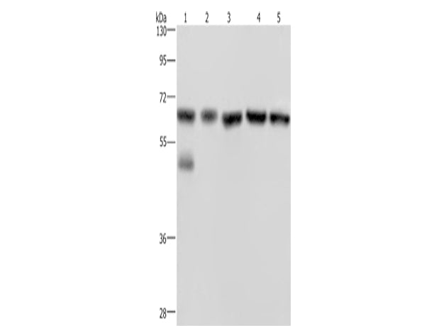NUP62 Polyclonal Antibody Store at -20°C, Biomarkers, Elabscience Biotechnology, MSE Supplies