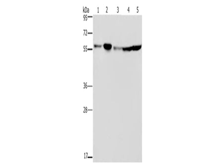 NUP50 Polyclonal Antibody Store at -20°C, Biomarkers, Elabscience Biotechnology, MSE Supplies
