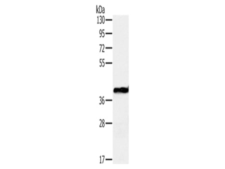 OTC Polyclonal Antibody Store at -20°C, Biomarkers, Elabscience Biotechnology, MSE Supplies