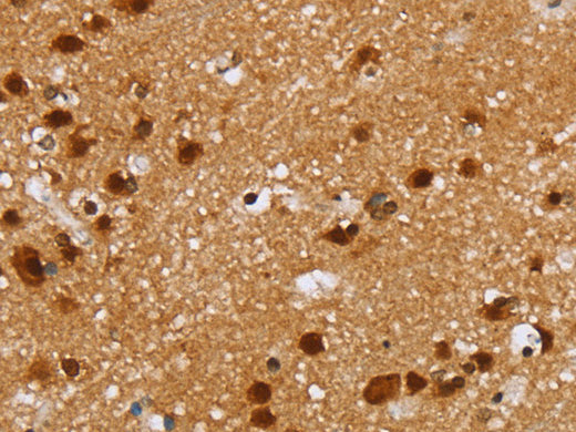 ZMAT3 Polyclonal Antibody Store at -20°C, Biomarkers, Elabscience Biotechnology, MSE Supplies